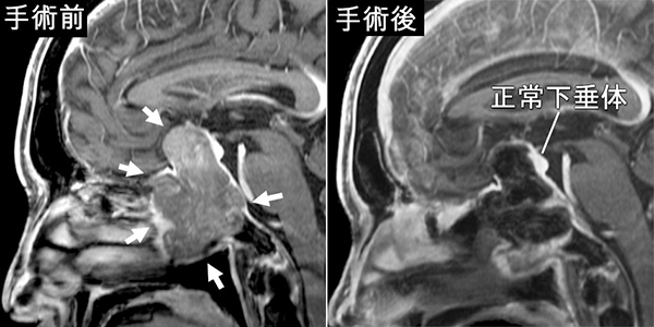 手術前・手術後の写真