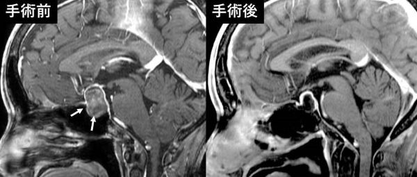 手術前・手術後の写真