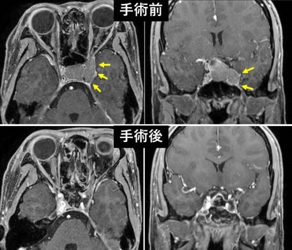 手術前・手術後の写真