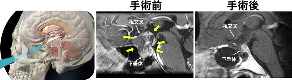 手術前と手術後の写真