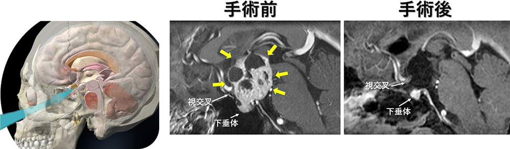 手術前と手術後の写真