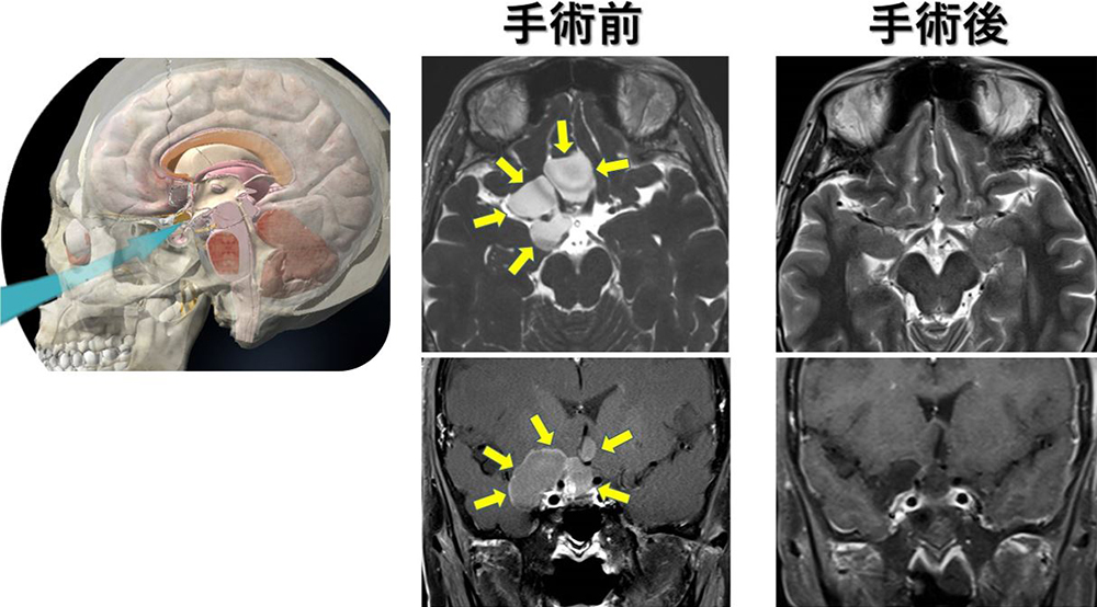 手術前と手術後の写真